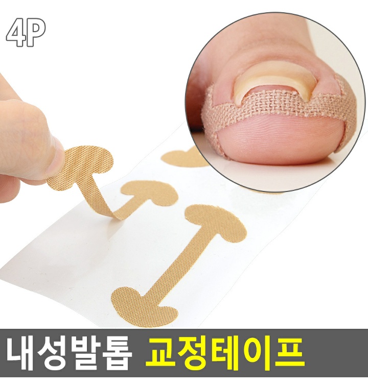내성발톱 교정테이프 내성발톱케어밴드 내성발톱관리테이프 내성발톱밴드 발톱테이프 - 티몬 내성발톱 교정테이프 내성발톱케어밴드 내성발톱관리테이프 내성발톱밴드 발톱테이프 - 티몬